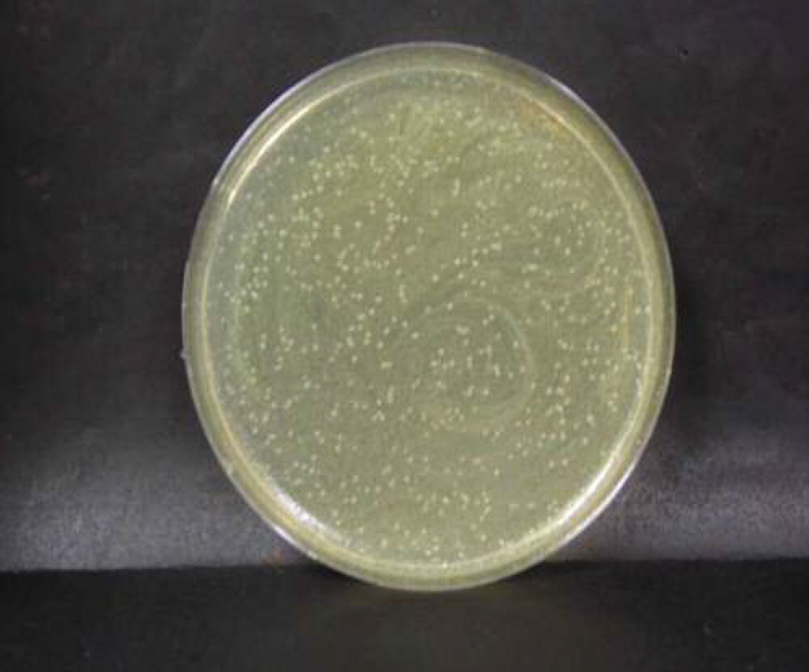 画像：腸炎ビブリオ菌　ブランク　n=1