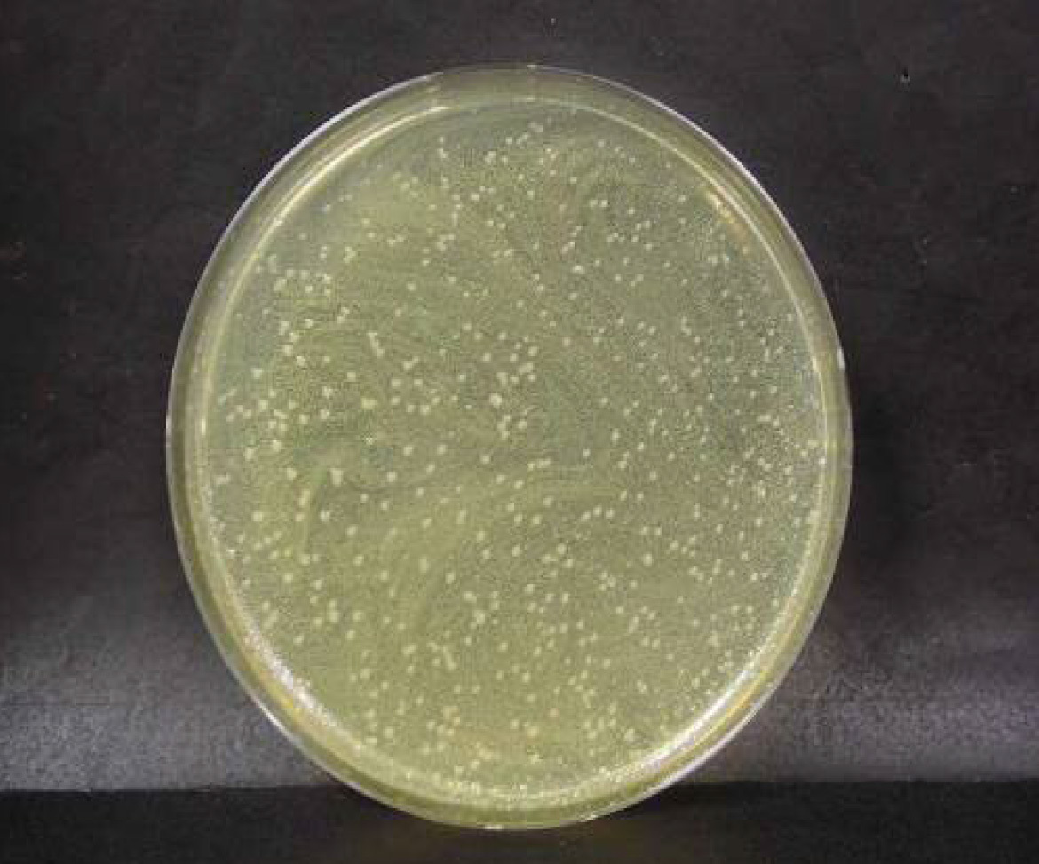 画像：腸炎ビブリオ菌　ブランク　n=2