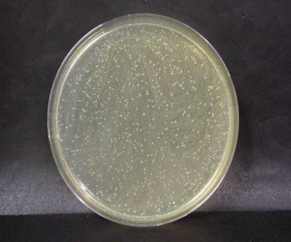 画像：腸炎ビブリオ菌　ブランク　n=3