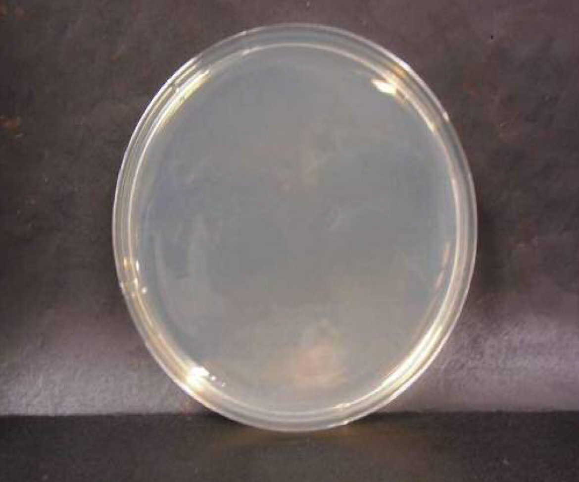 画像：腸炎ビブリオ菌　微酸性電解水接触後　n=3