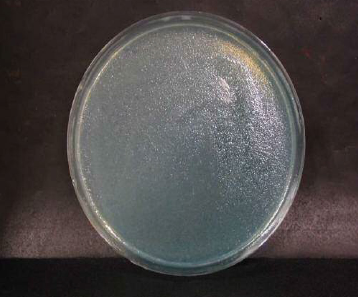画像：緑膿菌　ブランク　n=1